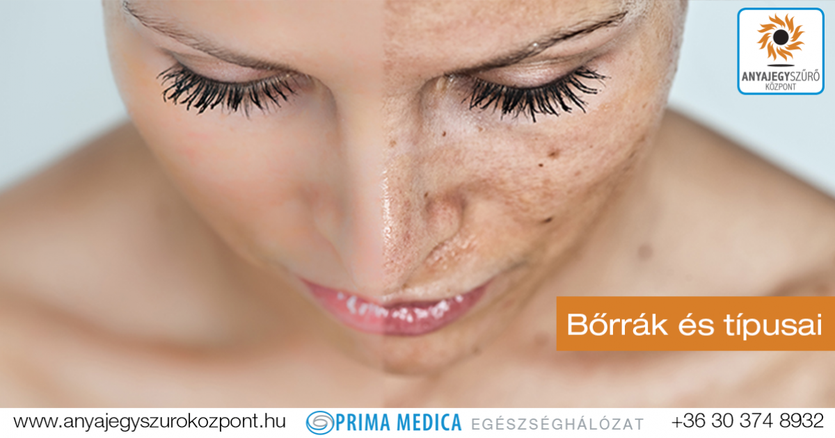 éjszaka 3 óra A Pinworm tabletta nem segít