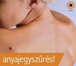 Hétvégi anyajegyszűrés