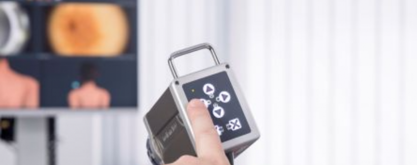 Mit kell tudni a teljes testtérképes anyajegyszűrésről?