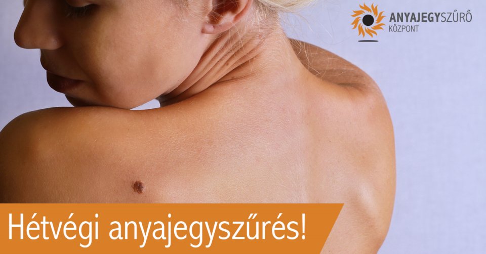 Hétvégi anyajegyszűrés Budapesten